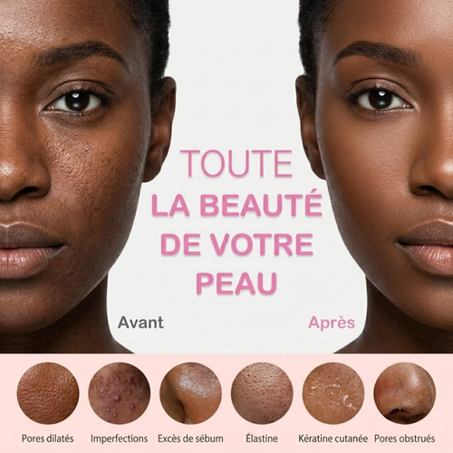 Nettoyante Sonique 3-en-1 — Nettoyage, Massage & Compresse Chaude